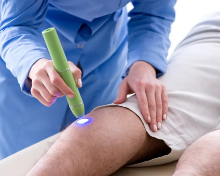 Eliminación de estrías y cicatrices — Arenas Clínica Médica