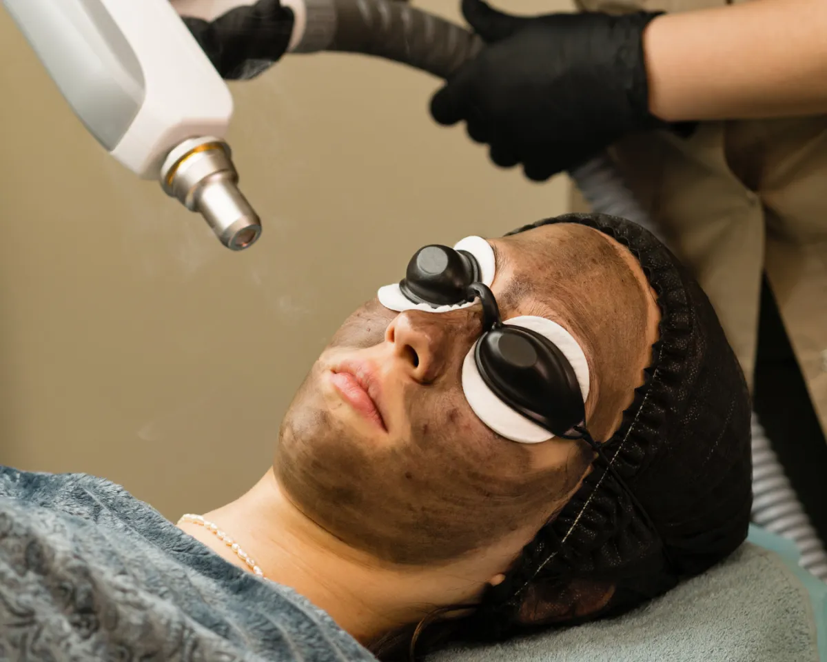 Hoollywood Peel