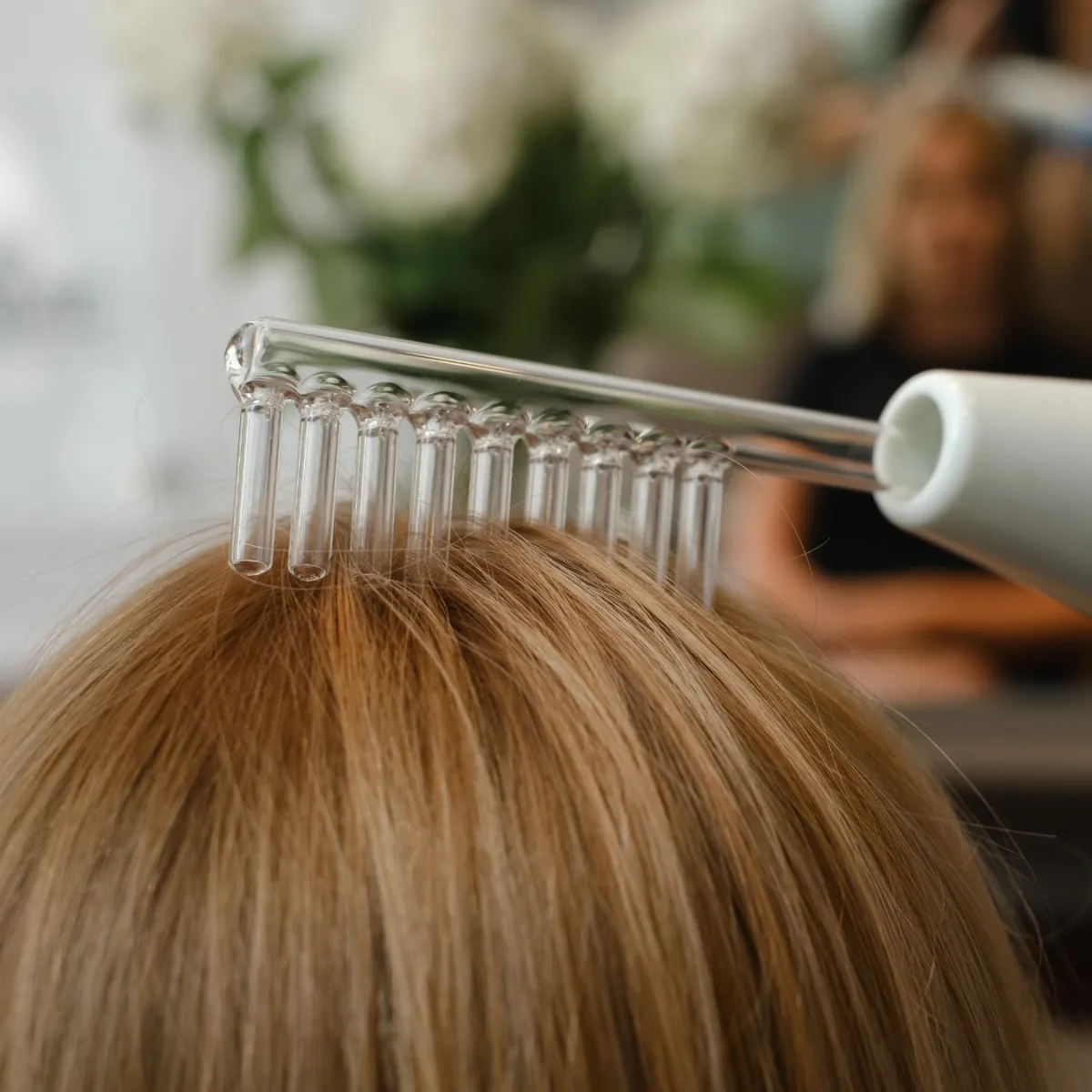 Grados de Alopecia