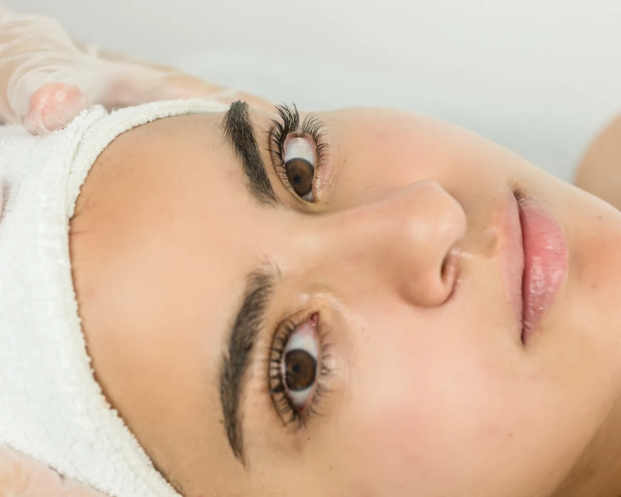 Inductores de Colageno (Radiesse/ HarmonyCA/ Sculptra)